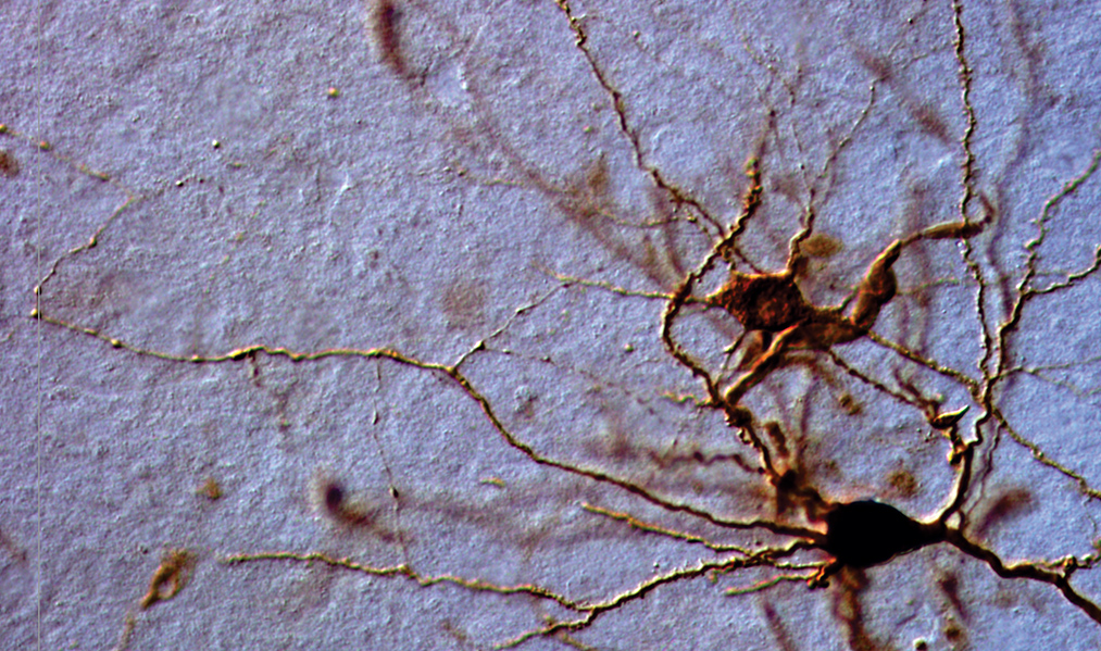 Gold stained neuron dendrites