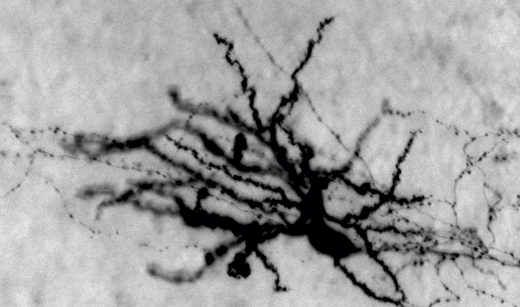 Neurons red and blue fluorescence