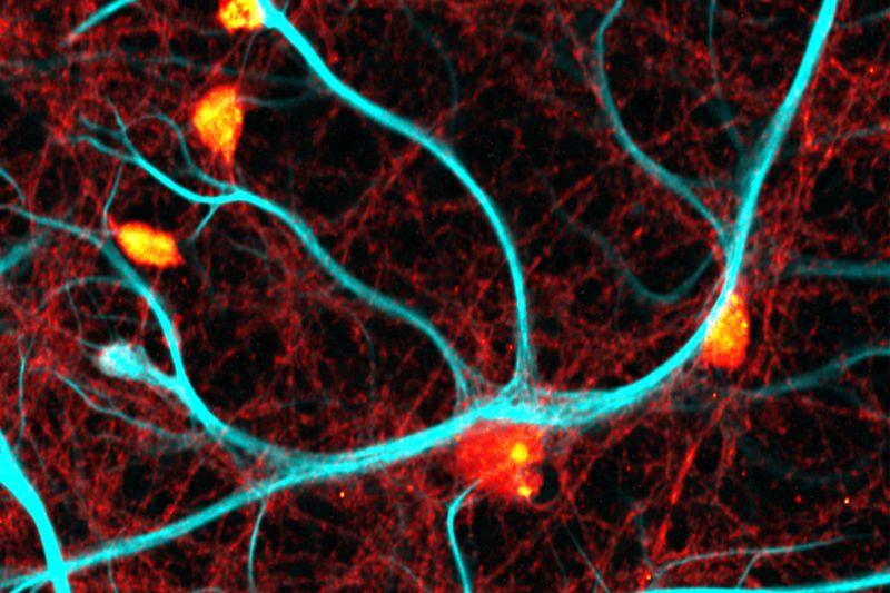 Turquoise fluorescent neurons